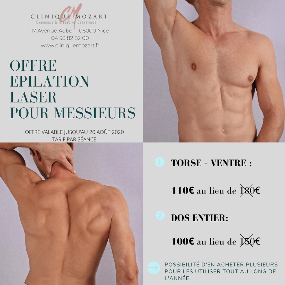 Tarifs epilation laser, hommes et femmes, Clinique Mozart a Nice Tarifs epilation laser, hommes et femmes, Clinique Mozart a Nice